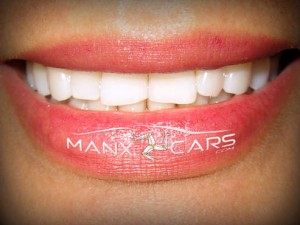 ManxCars.com about us